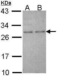 HPRT Rabbit Polyclonal Antibody