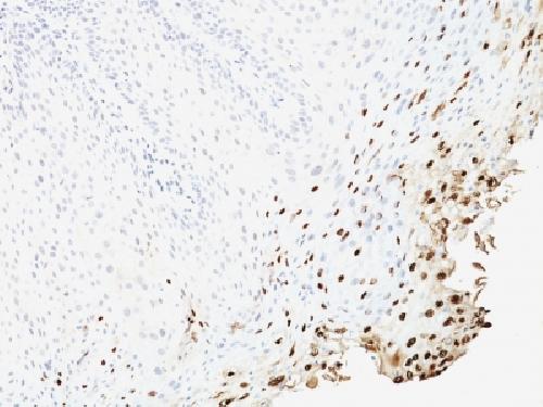 HPV-16 (Human Papilloma Virus 16) Antibody