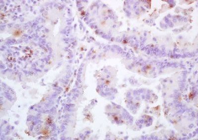 HPV16 E6 Mouse Monoclonal Antibody