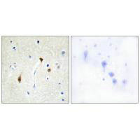 HR Antibody