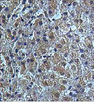 HRSP12 Rabbit Polyclonal Antibody