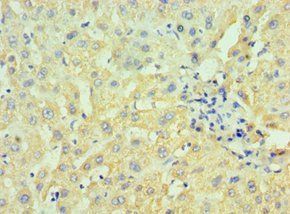 HSD17B4 Antibody