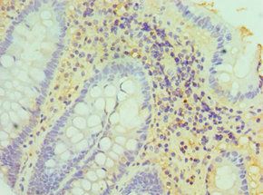 HSD17B4 Antibody