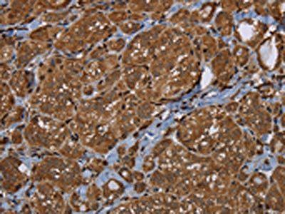 HSD17B4 Antibody