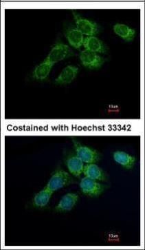 HSD17B4 Rabbit Polyclonal Antibody