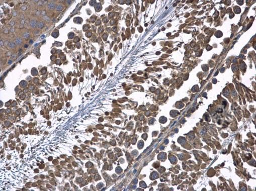 HSD17B4 Rabbit Polyclonal Antibody
