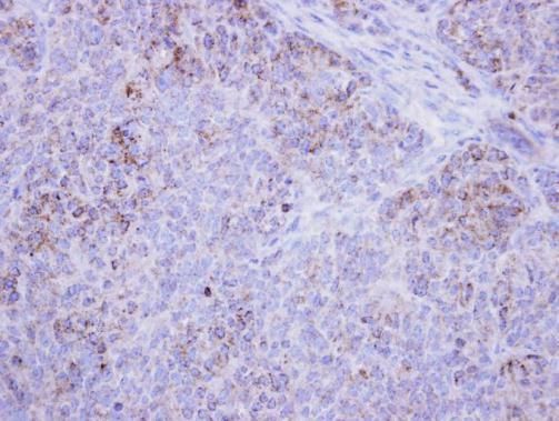HSD17B4 Rabbit Polyclonal Antibody
