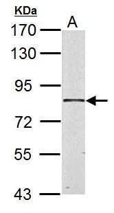 HSD17B4 Rabbit Polyclonal Antibody