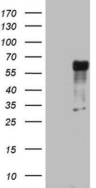 HSD17B8 Antibody