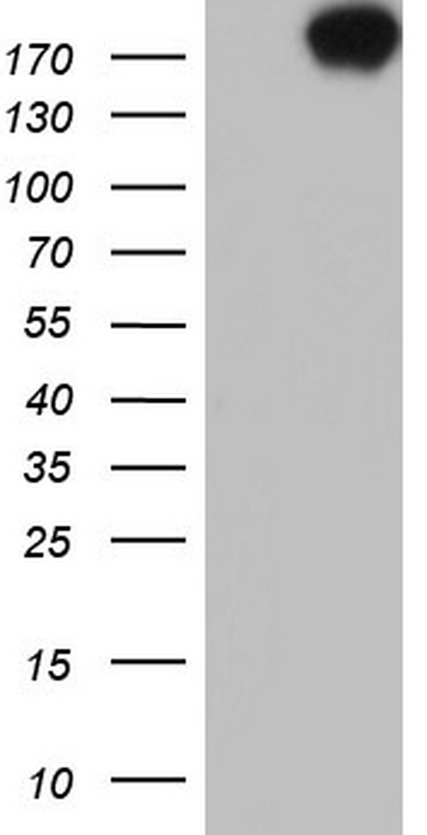 HSPD1 Antibody