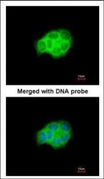HSPA6 Rabbit Polyclonal Antibody