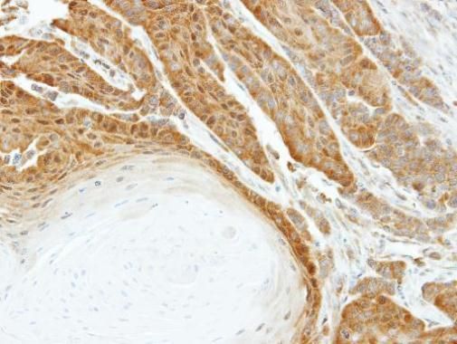 HSPA6 Rabbit Polyclonal Antibody