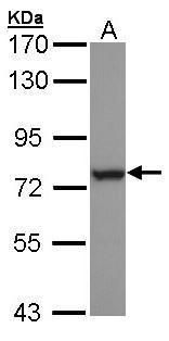 HSPA6 Rabbit Polyclonal Antibody