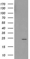 UBE2T Antibody