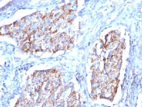 HSPD1 Antibody