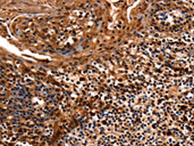 HSPD1 Antibody