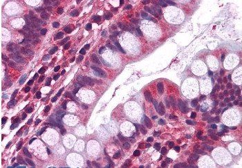 Serotonin receptor 3A/HTR3A Antibody