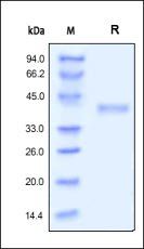Human R-Spondin 1 Protein, His Tag