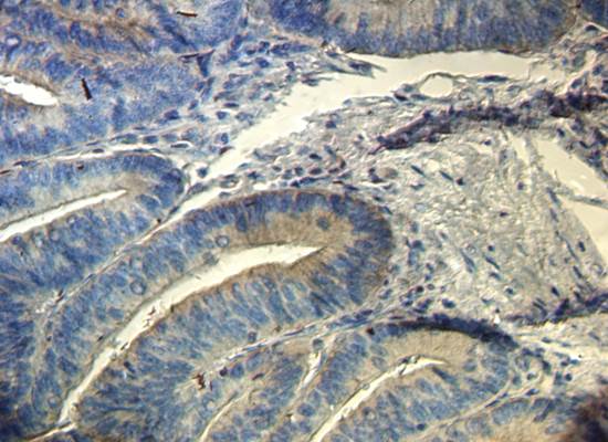 CD133 Rabbit Polyclonal Antibody