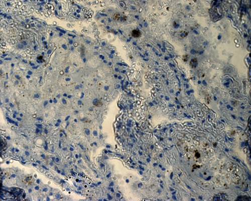 CD163 Rabbit Polyclonal Antibody