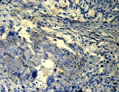 CD133 Rabbit Polyclonal Antibody