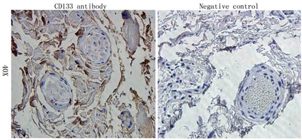 CD133 Rabbit Polyclonal Antibody