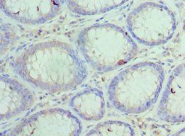 HYOU1 Antibody