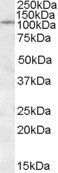 IA2 Antibody