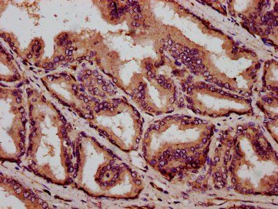 IBA57 Antibody