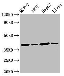 IBA57 Antibody