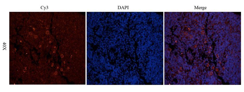 ICAM1 Rabbit Polyclonal Antibody