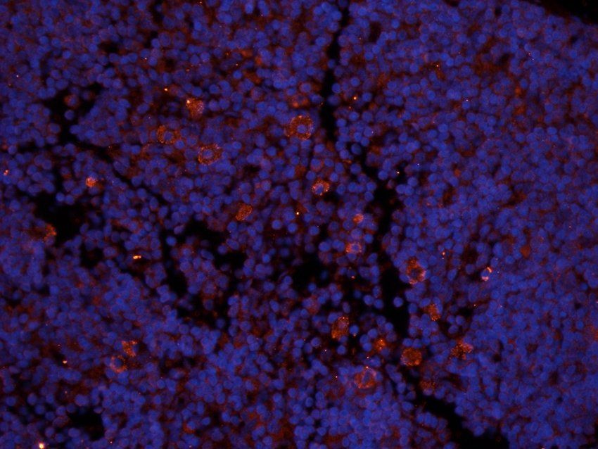 ICAM1 Rabbit Polyclonal Antibody
