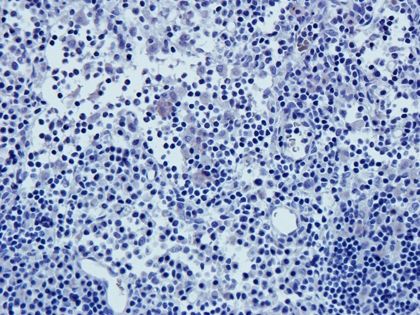 ICAM1 Rabbit Polyclonal Antibody