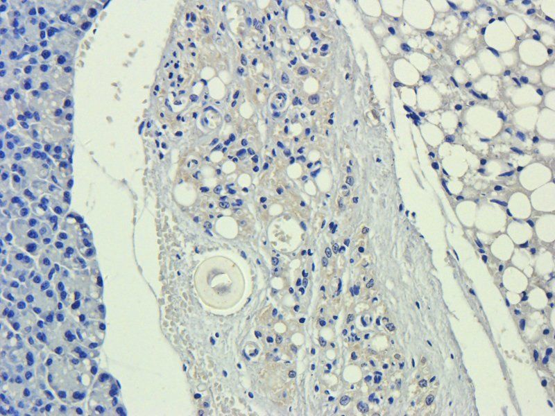 ICAM1 Rabbit Polyclonal Antibody