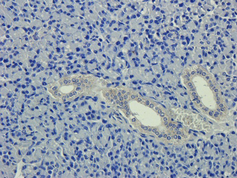 ICAM1 Rabbit Polyclonal Antibody