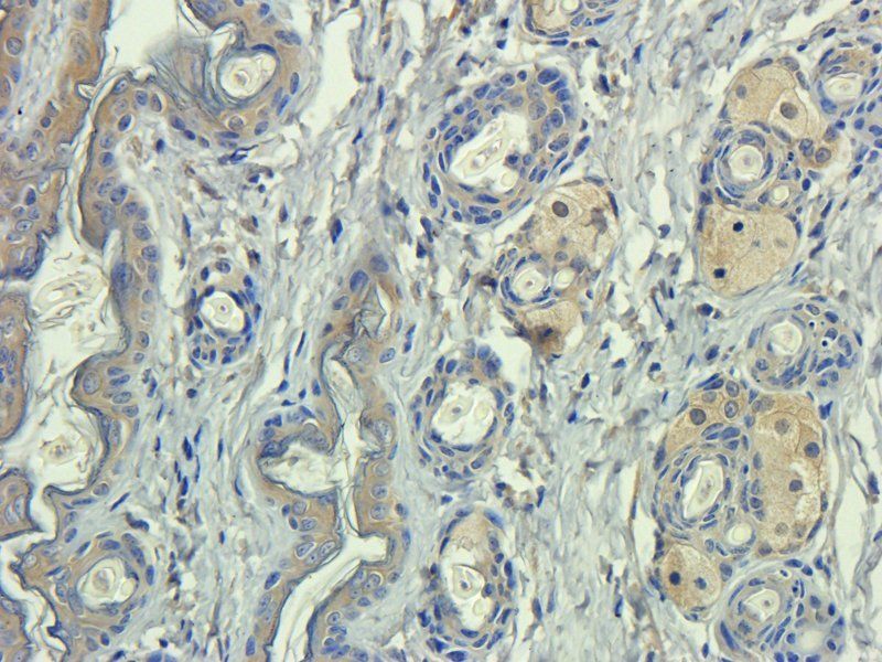 ICAM1 Rabbit Polyclonal Antibody