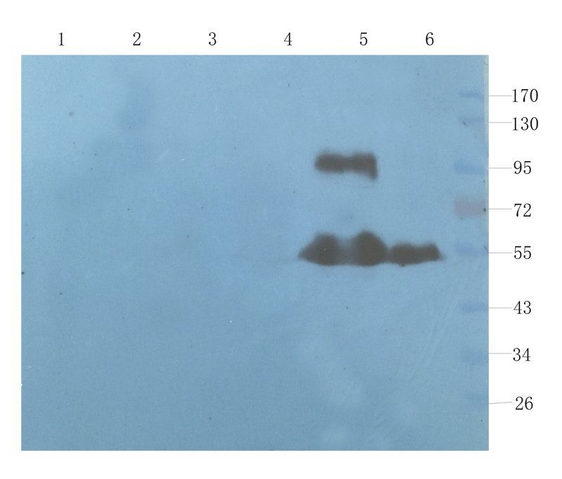 ICAM1 Rabbit Polyclonal Antibody