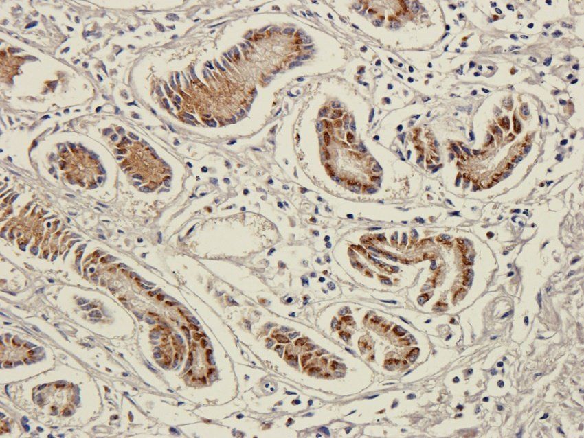 ICAM1 Mouse Monoclonal Antibody