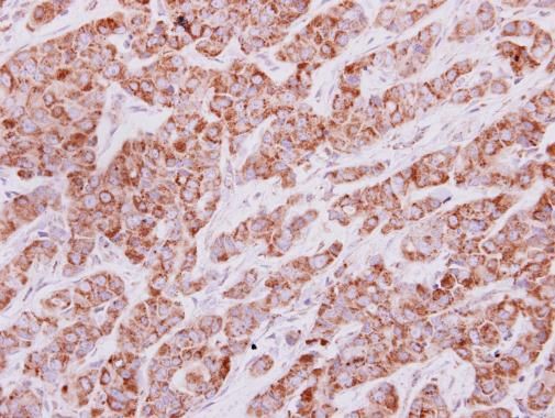 HPRT Rabbit Polyclonal Antibody