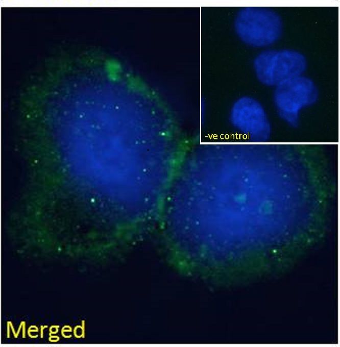 BLNK/SLP-65 Antibody