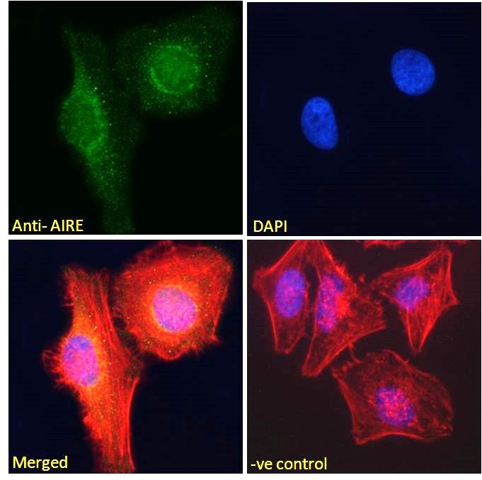Goat anti-AIRE Antibody