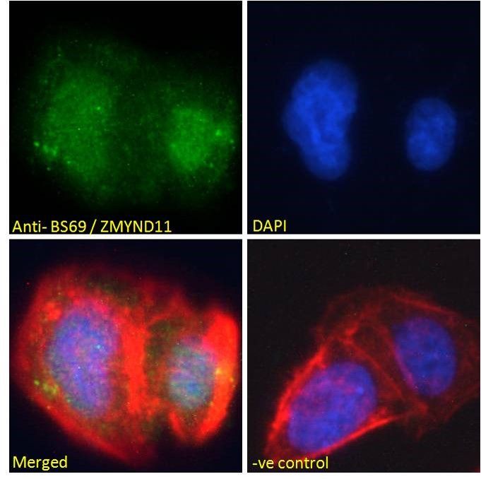 BS69/ZMYND11 Antibody