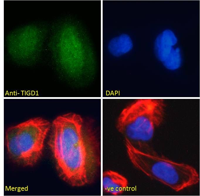 Goat anti-TIGD1 / EEYORE Antibody