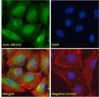 LXR beta/NR1H2 Antibody