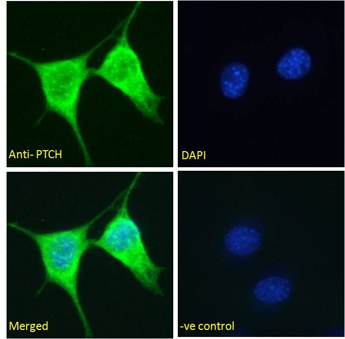 PTCH (C Terminus) Antibody