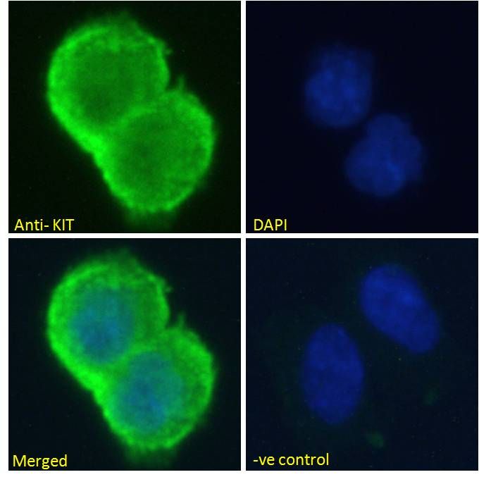 KIT/CD117 Antibody