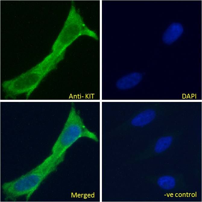KIT/CD117 Antibody