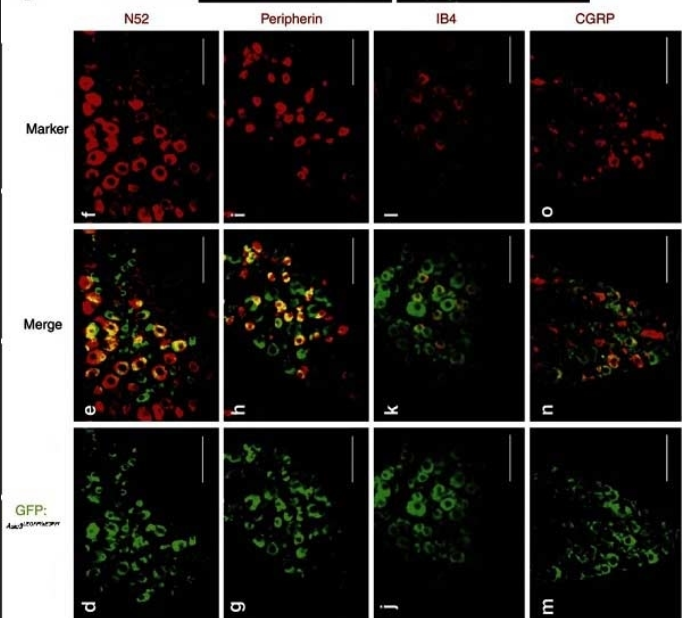 CGRP Antibody