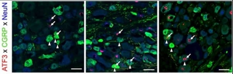 CGRP Antibody