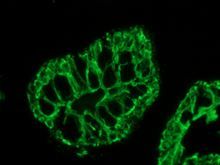 Mouse Cytokeratin 20 Antibody